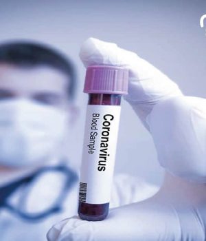 Islandia: la mejor estrategia contra el coronavirus. Islandia
