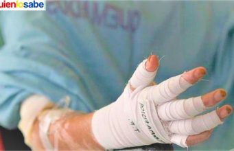 Se dispararon los quemados en Colombia estas fiestas